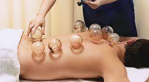 Cupping Therapy in Abbotsford | Medela Rehabilitation